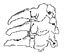 Hình 1 36 Phương pháp Whitehill buộc chỉ thép chồng 2 tầng Nguồn Whitehill 1987 8