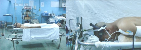 Hình 2 41 Nằm trên giường xoay Hình 2 42 Tư thế nằm phẫu thuật Nguồn từ tác 2