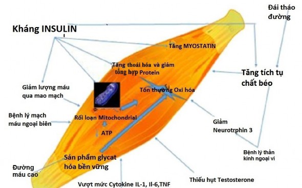 Hình 1 2 Các yếu tố ảnh hưởng tới mất cơ ở bệnh nhân ĐTĐ typ2 Theo Morley JE 1