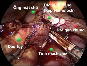 Nguồn BN Nguyễn Thị T 38T Mã số BA 18 03 11308 BM Nguồn BN Hoàng Quyết C 69T Mã sô 4
