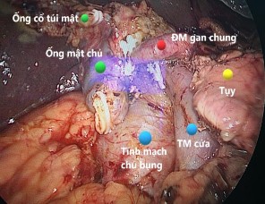 Nguồn BN Nguyễn Thị T 38T Mã số BA 18 03 11308 BM Nguồn BN Hoàng Quyết C 69T Mã sô 5