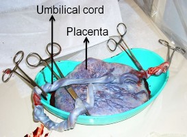 Hình 1 1 Rau thai và dây rốn chụp ngay sau khi sinh Nguồn Hamad Ali 2012 Stem Cell 1