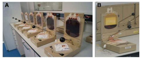 Hình 1 6 Quá trình xử lý máu dây rốn bằng phương pháp thủ công 1 2 1 3 Bảo 2