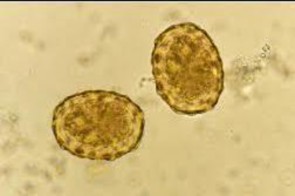 Hình 1 2 Trứng giun đũa Nguồn trích dẫn http cdc gov parasites Ascariasis 12 Chu kỳ 2