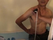 Hình 2 31 Hình ảnh siêu âm khảo sát cơ trên gai Nguồn ảnh chụp trong mổ của BN 15