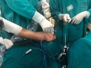 Hình 2 23 Dụng cụ tạo vi tổn thương Nguồn ảnh chụp trong mổ của BN Phan Quang 2