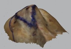 Hình 3 6 Minh hoạ bờ ngoài diện bám gân dưới vai ở phía trên và phía dưới 10