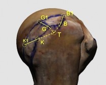 Hình 3 4 Minh hoạ cách đo KC từ điểm hội tụ đến các điểm trước ngoài của 7