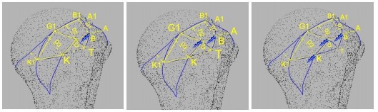 Hình 4 2 Minh hoạ vị trí đặt neo khâu CX theo phương pháp một hàng Nguồn Ảnh 2