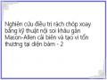 Nghiên cứu điều trị rách chóp xoay bằng kỹ thuật nội soi khâu gân Mason-Allen cải biên và tạo vi tổn thương tại diện bám - 2