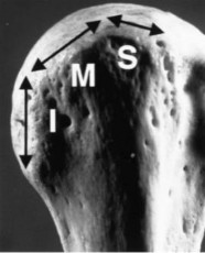 Hình 1 2 Minh họa ba cạnh của củ lớn S là cạnh trên M là cạnh giữa I là cạnh 2