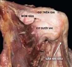 Hình 1 6 Nhìn từ phía trước của khớp vai 32 Trong báo cáo của Clark và Harryman 6