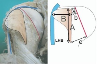 Hình 1 7 Diện bám gân dưới vai A độ dài lớn nhất tính theo chiều dọc B độ 7