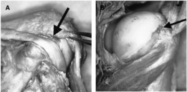 Hình 1 10 Hình A mô tả bờ trước của củ lớn Hình B mô tả điểm đầu của 2