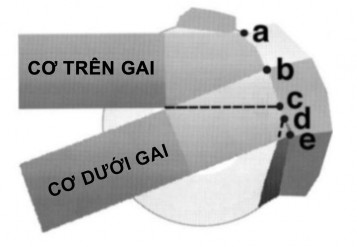 Hình 1 11 Minh họa mối liên quan giữa gân trên gai và dưới gai với mốc giải 3