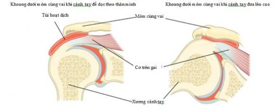 Hình 1 13 Giải phẫu động học khoang dưới mỏm cùng38 Nguyên nhân bên ngoài 5