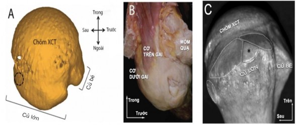 Hình 2 1 Hình vẽ mô tả quy ước của các thuật ngữ dùng trong nghiên cứu giải 3