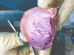 Hình 2 2 Tách rời mẫu vật để phẫu tích Nguồn Ảnh phẫu tích trong nghiên cứu 1