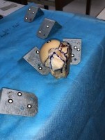 Hình 2 7 Minh hoạ định vị quanh vật thể bằng các miếng dán định vị Nguồn 6