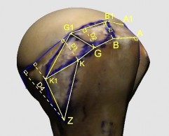 Hình 2 10 Minh hoạ cách đo các mốc cần xác định diện bám gân chóp xoay vào củ 8