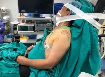 Hình 2 14 Tư thế phẫu thuật Beach chair và tư thế nằm nghiêng của BN Nguồn ảnh 10