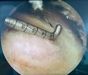 Hình 2 21 Đo xác định vị trí đặt neo bờ ngoài dựa vào các chỉ số KC về 19