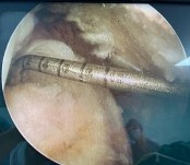 Hình 2 21 Đo xác định vị trí đặt neo bờ ngoài dựa vào các chỉ số KC về 20