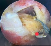 Hình 2 21 Đo xác định vị trí đặt neo bờ ngoài dựa vào các chỉ số KC về 21