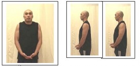 Hình 4 Bài tập nhún vai Hình 5 Bài tập co xương bả vai Hình 6 Bài tập con lắc A 1