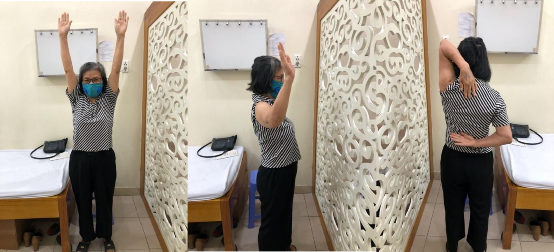 Hình phụ lục 1C Kết quả khám lại sau mổ Nguồn BN nghiên cứu Hình phụ lục 1B 5