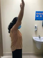 Hình phụ lục 3D Hình ảnh khám lại lâm sàng sau mổ Nguồn BN nghiên cứu Trường 15