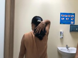 Hình phụ lục 3D Hình ảnh khám lại lâm sàng sau mổ Nguồn BN nghiên cứu Trường 16