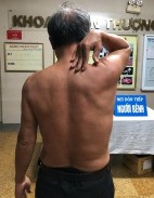 Hình phụ lục 2D Hình ảnh khám lại sau mổ Nguồn BN nghiên cứu Đây là ca lâm 9