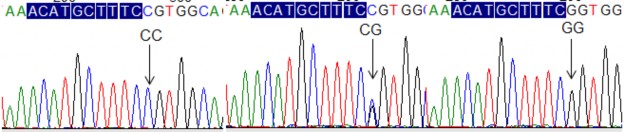 5’UTR 4G A Codon52 Codon54 Codon57 I Hình FCN2 986G A ảnh phân tích kết quả giải 2