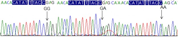 Codon52 Codon54 Codon57 I Hình FCN2 986G A ảnh phân tích kết quả giải trình tự xác 3