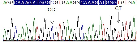 Codon54 Codon57 I Hình FCN2 986G A ảnh phân tích kết quả giải trình tự xác định 4