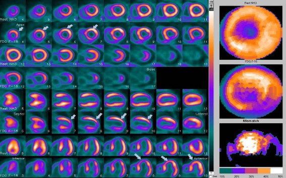 Hình 1 5 Kết quả khảo sát tính sống còn trên xạ hình PET 2 đồng vị gồm xạ 2