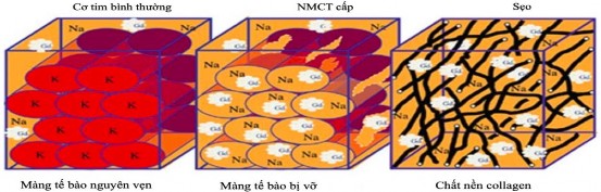 Hình 1 7 Cơ chế giải thích của dấu hiệu ngấm thuốc muộn Nguồn Garcia M J et al 4