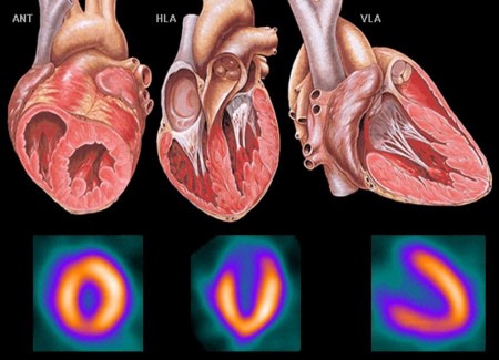 Trục ngắn Trục dài dọc Trục dài ngang Hình 2 3 Hình ảnh minh họa tái tạo các 1