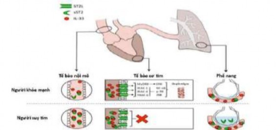 Hình 1 6 Các nguồn sản xuất protein sST2 trong suy tim Nguồn Antonio Bayés Genis 2018 1