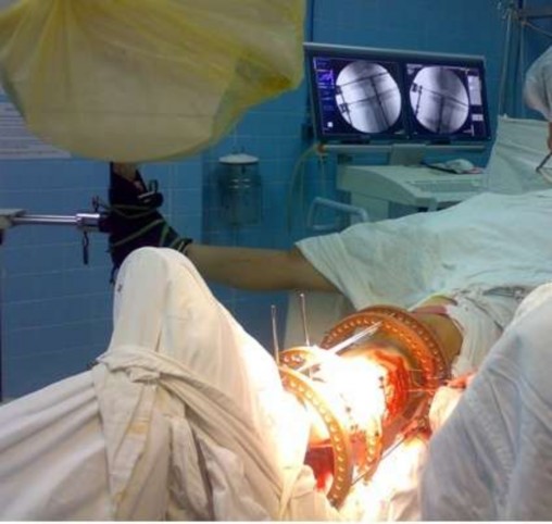 Hình 2 8 Máy C arm kiểm tra kết quả nắn quá trình kết hợp xương tối thiểu và 1