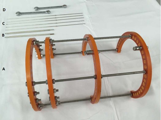 Hình 2 2 Dụng cụ sử dụng trong nghiên cứu A Khung cố định ngoài dạng vòng 3