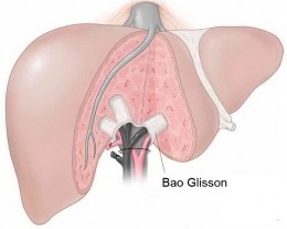 Hình 1 5 Hình cấu trúc giải phẫu vùng cuống gan và bao Glisson Nguồn Cho 2007 26 3