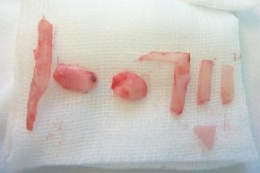 Hình 3 1 Tạo hình mảnh ghép với mảnh ghép hình chữ L Cách cố định mảnh ghép 5