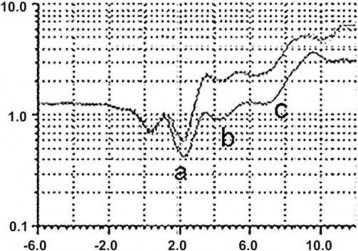 Biểu đồ 1 2 Biểu đồ trước đường dưới và sau đường trên khi dùng thuốc 1