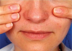 Hình 1 14 Nghiệm pháp Cottle A Nguồn Robert F Andre 2008 100 Hình 1 15 Hình ảnh van mũi 2