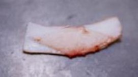 Hình 1 29 Sụn sườn sau khi được lấy 1 4 4 Phẫu thuật chỉnh hình van mũi với 11