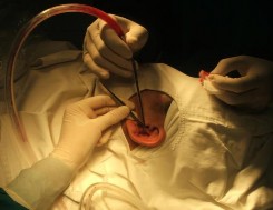 Hình 1 26 Lấy sụn vành tai từ mặt trước Hình 1 27 Sụn vành tai lấy từ mặt 8