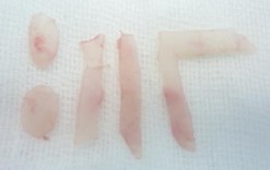 Hình 2 3 Tạo hình mảnh ghép với SG cải tiến hình L Cách cố định mảnh ghép 5