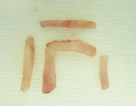 Hình 2 3 Tạo hình mảnh ghép với SG cải tiến hình L Cách cố định mảnh ghép 6